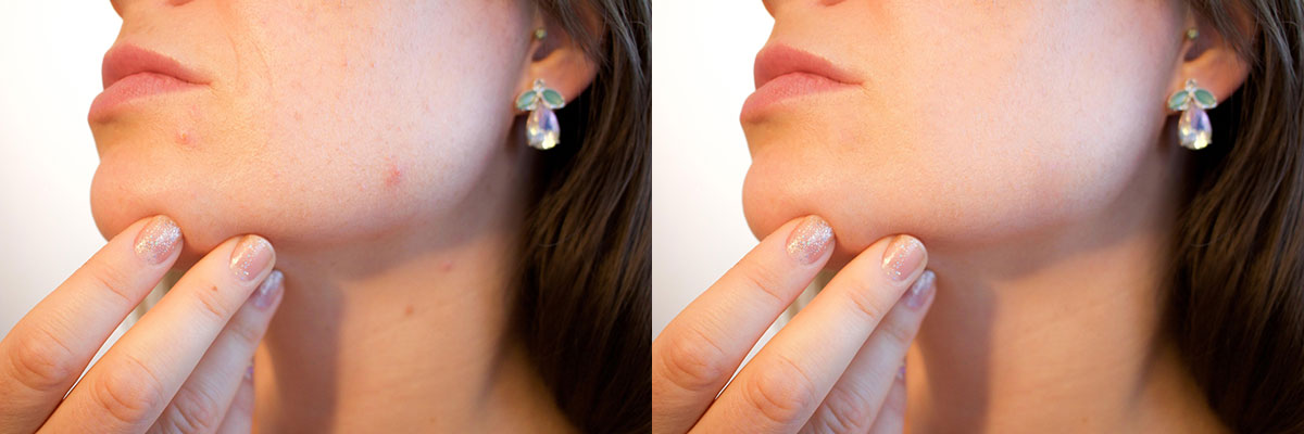 Exemple de correction avec l'outil Correcteur localisé Exemple de correction avec l'outil Correcteur localisé