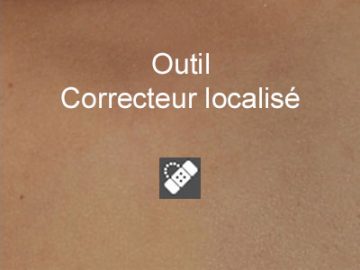 Effacer des taches sur la peau avec l'outil Correcteur localisé