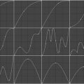 Paramètres Contours (1)